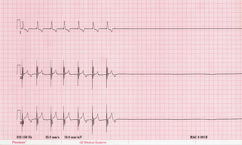 ECG 21 under anesthesia 1