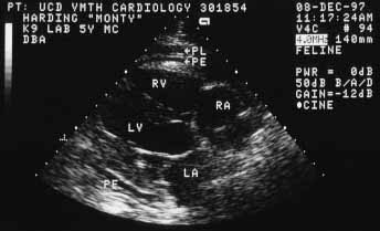 Right parasternal long-axis echocardiographic view showing small pericardial effusion (PE) and moderate pleural effusion (PL) with a morphologically normal heart