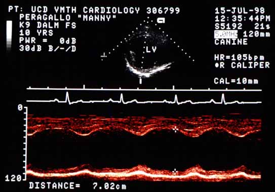 M-mode echocardiogram with end-diastolic measurement markers showing LV EDD of 7 cm.