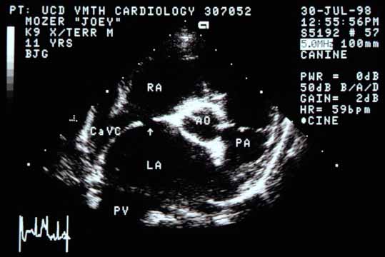 Right parasternal cross-sectional view of the base of the heart showing the markedly enlarged left atrium (LA) compared to the aorta (Ao). The caudal vena cava (CaVC) enters the right atrium (RA). There again appears to be a defect in the interatrial septum.