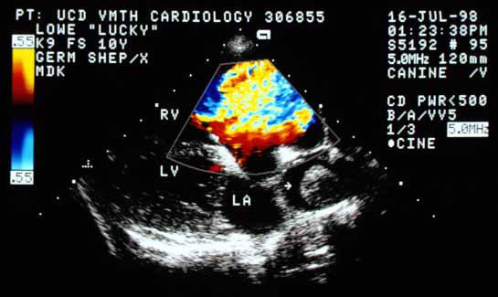 Color flow Doppler in systole showing flow from the RV into the RA — tricuspid regurgitation despite the absence of an audible systolic murmur. The jet is large and fills the RA, suggesting at least moderate to severe TR. LV — left ventricle; LA — left atrium.