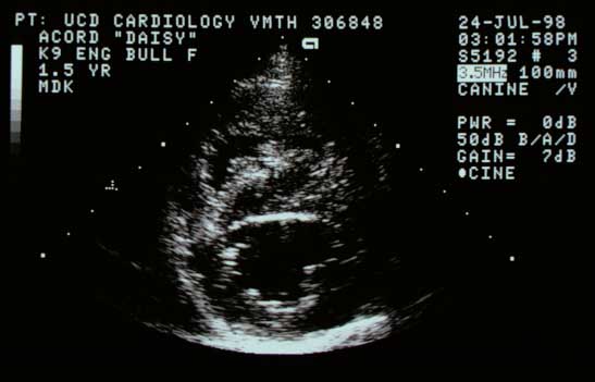 Right parasternal short-axis view at the ventricular level showing the thickened right ventricular free wall and enlarged right ventricular cavity.