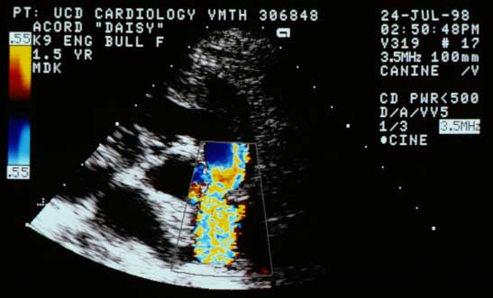 Color flow Doppler image (same short-axis base view as before) recorded in systole, showing turbulent high-velocity flow across the stenotic pulmonic valve into the main pulmonary artery.