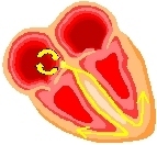 Schematic of AV nodal reentry in a patient.