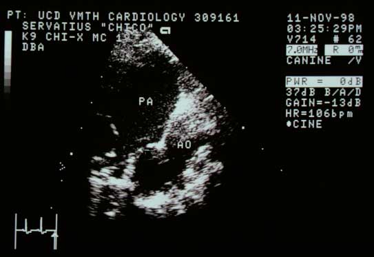 Left-sided echocardiographic view showing the proximal descending aorta (AO) and main pulmonary artery (PA) with a structure between them.