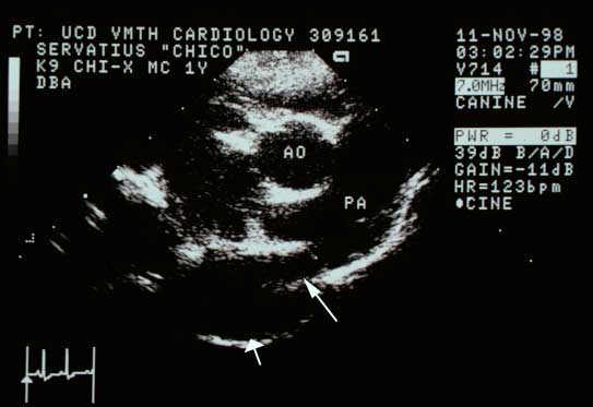 Same basilar view with arrows. Short fat arrow points to the descending aorta. Longer arrow points to a structure between the aorta and pulmonary artery — the patent ductus arteriosus.