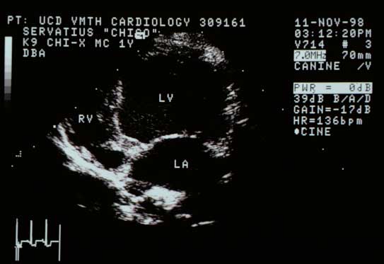 Left apical four-chamber view showing the same findings as the long-axis view — enlarged left heart chambers.