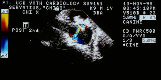 Post-coil color flow Doppler showing two small residual jets through the thrombus and ductus.