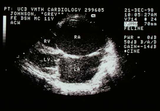 Same view with increased gain showing flocculated densities (spontaneous echocardiographic contrast or 'smoke') swirling within the chambers, especially apparent in the left atrium. This occurs when blood flow velocity slows, allowing red cells to aggregate.