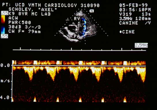 Continuous wave Doppler measuring peak systolic flow velocity in the right ventricular outflow tract at approximately 2 meters per second.