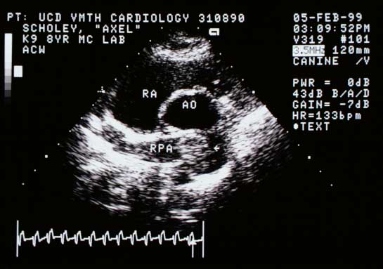 Cross-sectional view at the pulmonary artery branches showing the top of the structure in the main pulmonary artery, at least partially occluding the right caudal lobar pulmonary artery branch (RPA). AO — aorta; RA — right atrium.