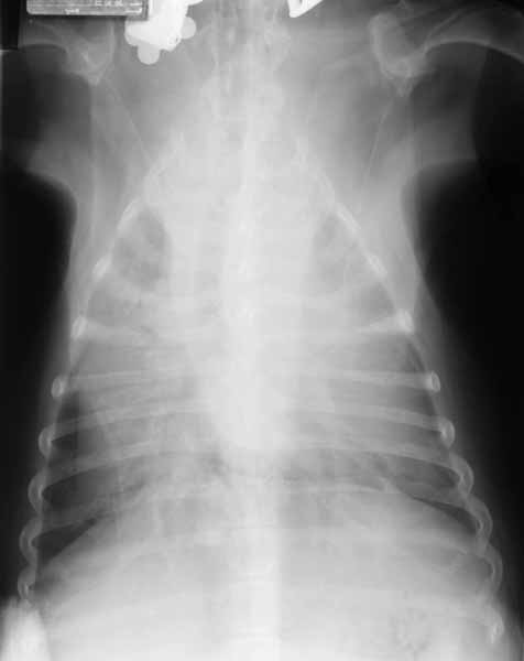 Dorsoventral thoracic radiograph in which the cardiac silhouette cannot be clearly discerned due to a small amount of pleural effusion obscuring the cardiac borders