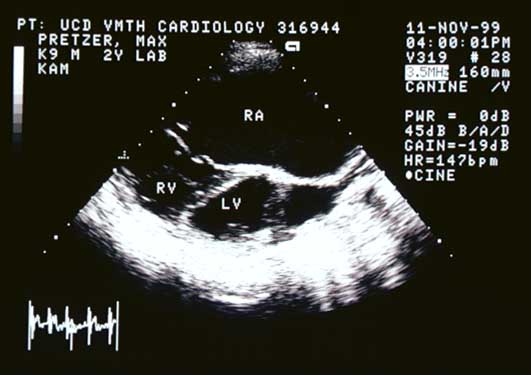 Second right parasternal long-axis echocardiogram in systole.
