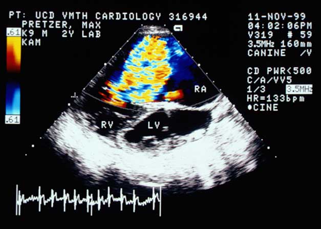 Color flow Doppler in the right parasternal long-axis view during systole showing severe tricuspid regurgitation.