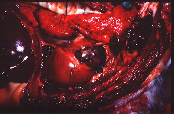 Post mortem photograph from another dog showing a right atrial hemangiosarcoma.