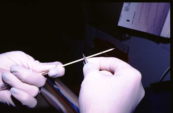16-gauge Angiocath catheter prepared with small side holes cut using a scalpel blade.