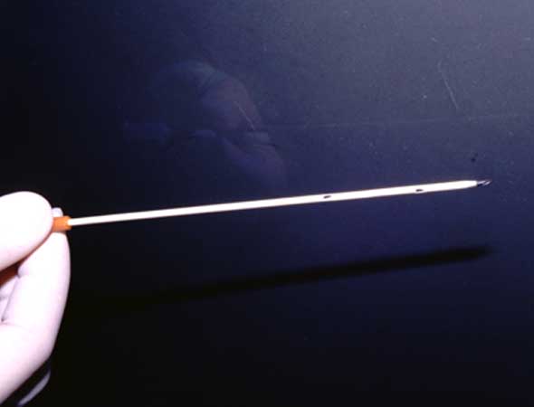 Close-up of the prepared catheter showing the side holes.