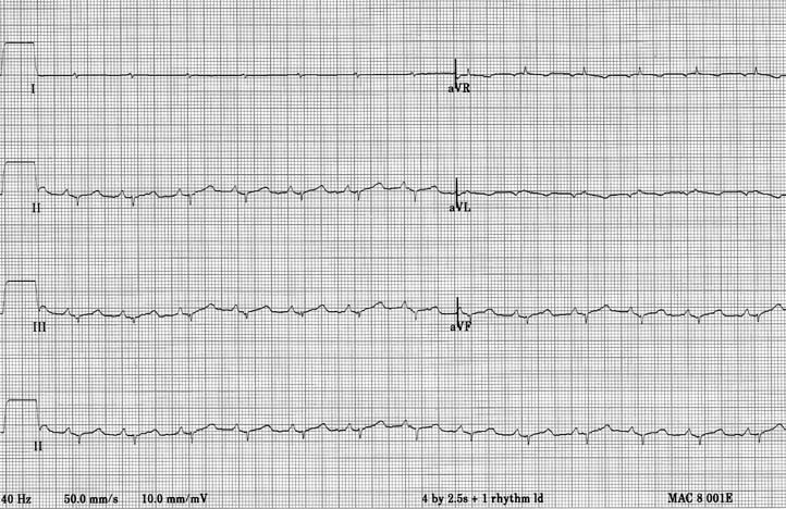 Six limb lead ECG showing small QRS complexes even for a cat, with the mean electrical axis directed toward the head.