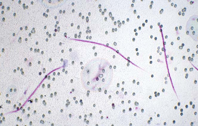 Difil filter test showing microfilariae on the filter, confirming circulating Dirofilaria immitis larvae.