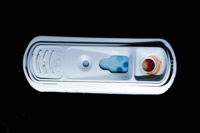 SNAP heartworm antigen test showing positive control, low worm burden, and high worm burden spots all turning blue, indicating a heavy heartworm infestation.