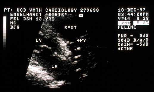 Right parasternal echocardiogram showing outflow tract and pulmonic valve.