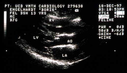 Right parasternal long-axis echocardiogram.