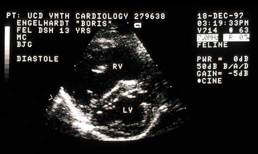 Right parasternal short-axis echocardiogram during diastole showing septal flattening.