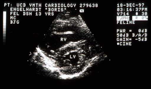 Right parasternal short-axis echocardiogram during systole.