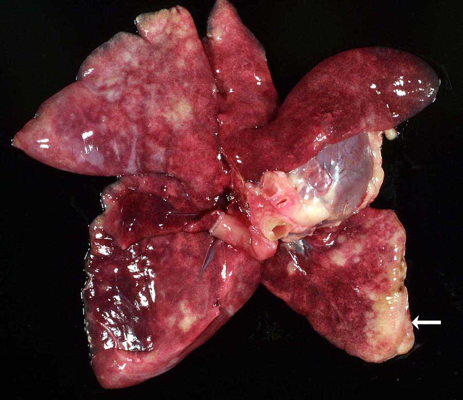 Gross pathology of Boris's heart and lungs showing regions of fibrosis.