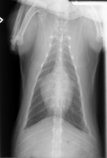 VD radiograph