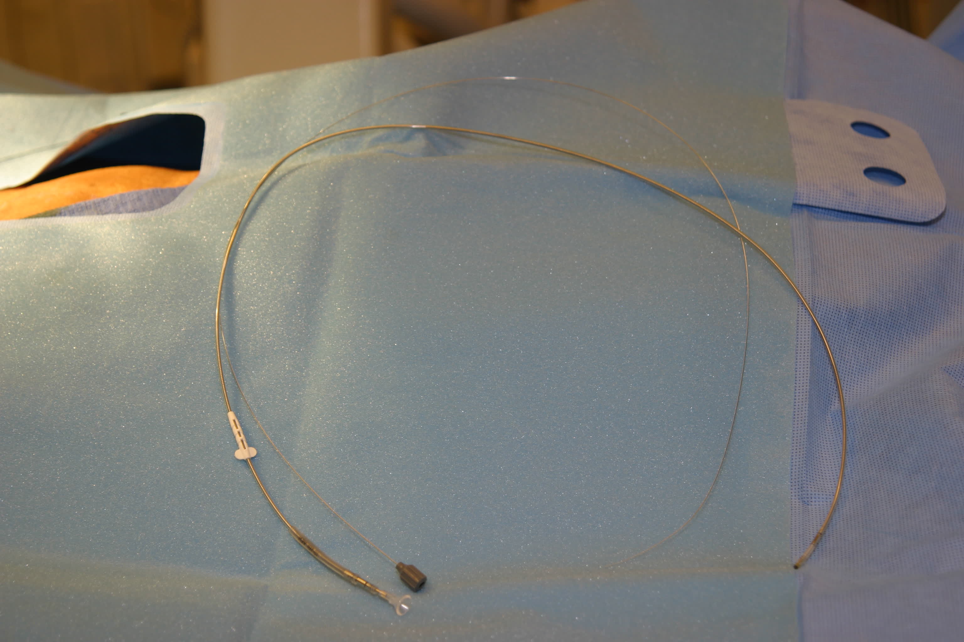 Pacemaker implantation image 2