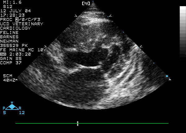 Left apical four-chamber view, early systole