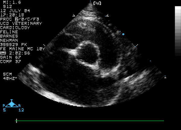 Short-axis view of the aorta and left atrium