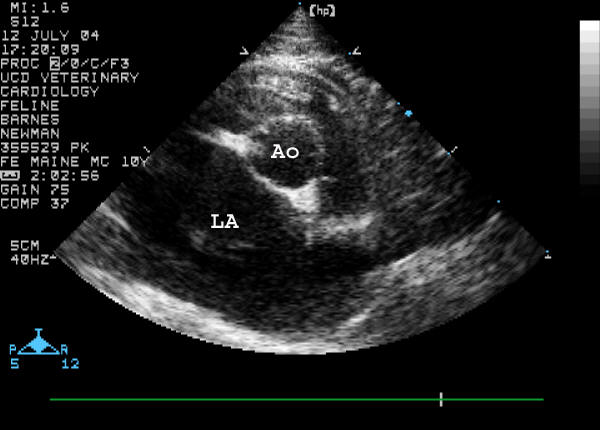 Short-axis view of the aorta and left atrium, labeled
