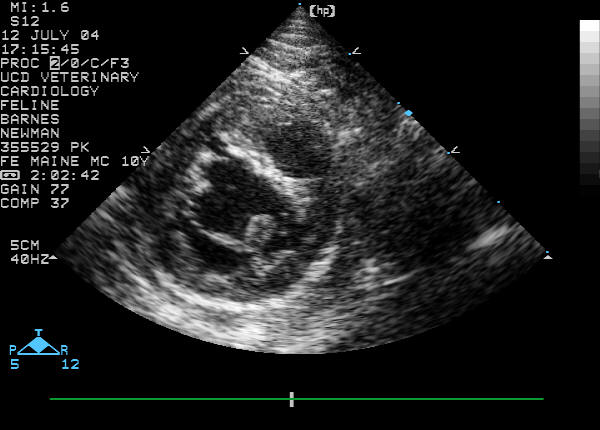 Right parasternal short-axis view of the left ventricle, second view