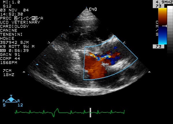 Right parasternal long-axis color flow Doppler diastole