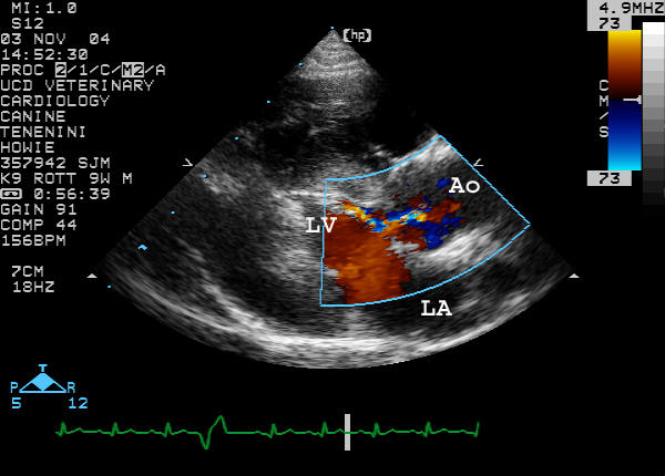 Right parasternal long-axis color flow Doppler diastole labeled
