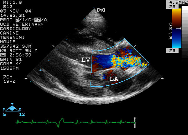 Right parasternal long-axis color flow Doppler systole labeled