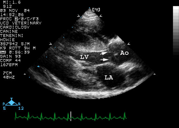 Right parasternal long-axis view labeled