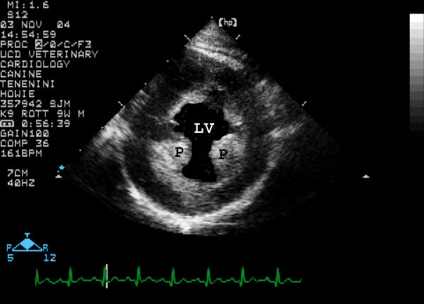Right parasternal short-axis view of LV labeled
