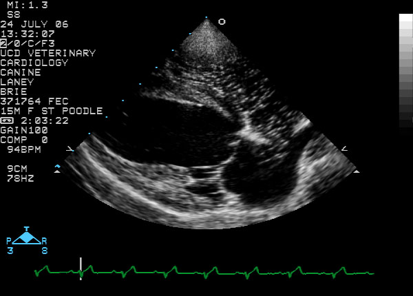Contrast echo right parasternal long-axis view - systole
