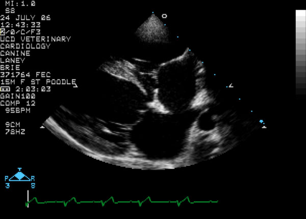 Right parasternal long-axis view