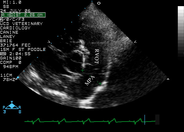 Pulmonic artery measurement