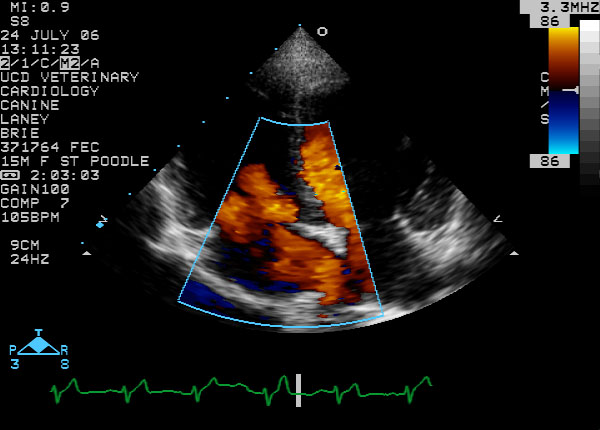 Color flow left apical four-chamber view - diastole