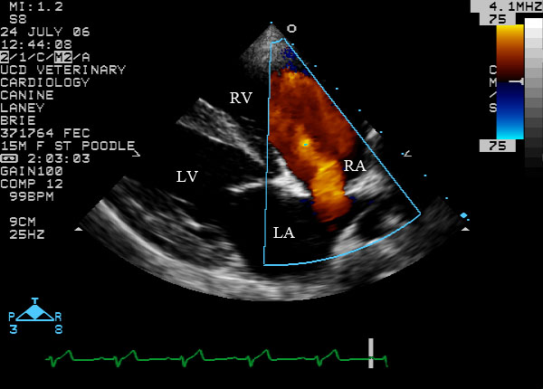Color flow right parasternal long-axis view - diastole - labeled