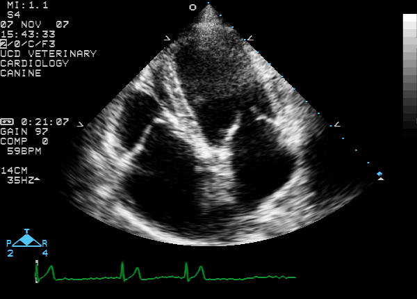 Left apical four-chamber view
