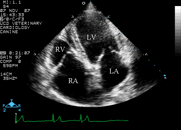 Left apical four-chamber view labeled