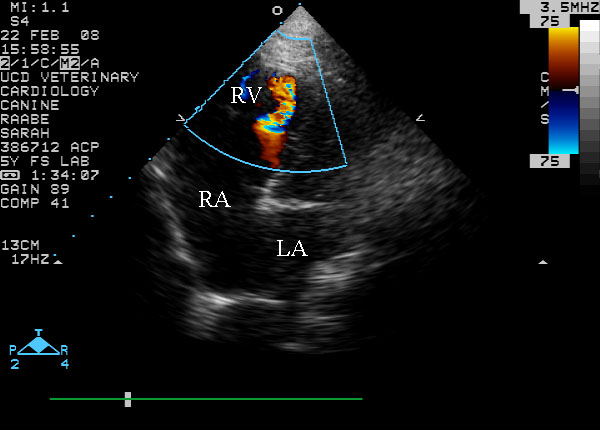 Color flow Doppler left apical view labeled