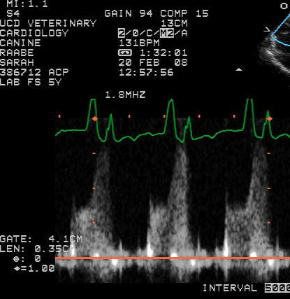 Pulsed wave Doppler