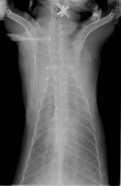 Dorsoventral (DV) thoracic radiograph. The cardiac silhouette margins are indistinct due to a small amount of pleural effusion. Pulmonary infiltrates are visible bilaterally.